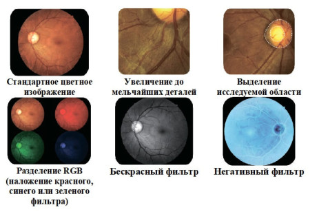 Фундус-камера офтальмологическая Crystalvue NFC-700 (стандартная)