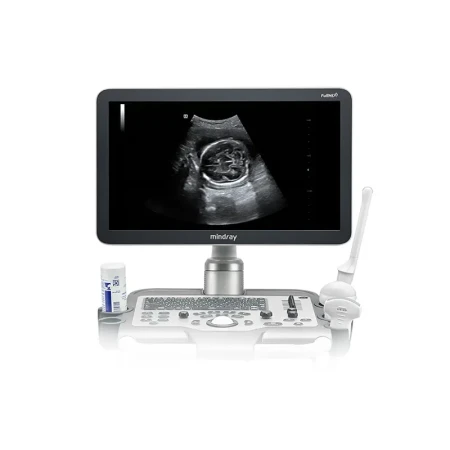 Система диагностическая ультразвуковая Mindray DC-30 (стационарный)