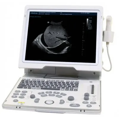 Система диагностическая ультразвуковая Mindray DP-50